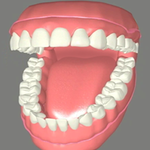 Complete dentures