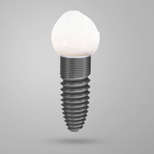 Everything You Need to Know About Dental Implants | Linden
