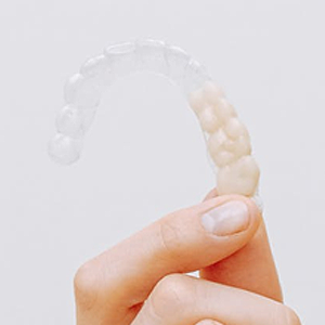 5 Smile Flaws That Invisalign Can Fix | Clark | Linden
