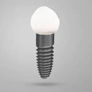 Top Reasons to Visit a Dental Implant Dentist in Colonia Top Reasons to Visit a Dental Implant Dentist in Colonia